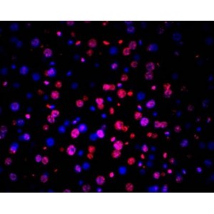 TUNEL LiFluor™ 594 Apoptosis Detection Kit (50 rxns)